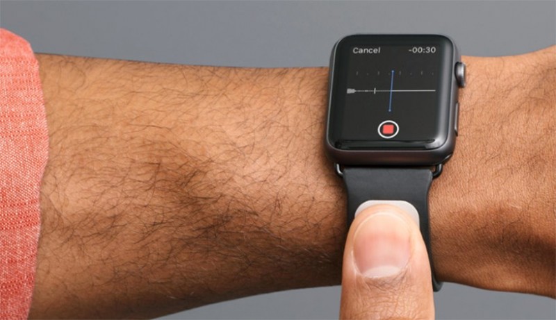 apple-watch-band-with-medical-grade-ekg-can-detect-a-stroke3